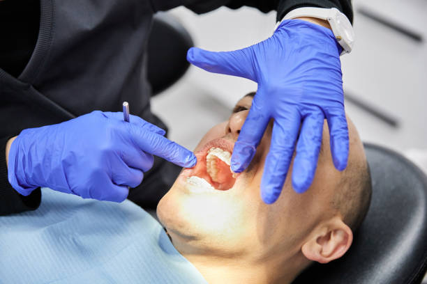 Best Emergency Root Canal Treatment in Collierville, TN
