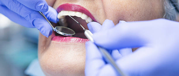 Best Emergency Broken Tooth Repair in Collierville, TN